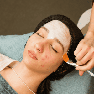 teen getting facial skincare to clear up acne